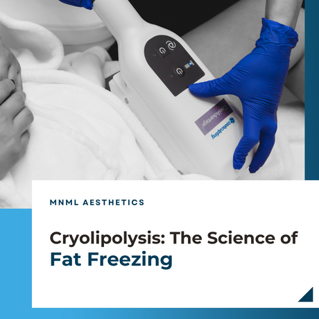 Cryolipolysis: The Science of Fat Freezing