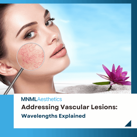Addressing Vascular Lesions with Precision: Wavelengths Explained