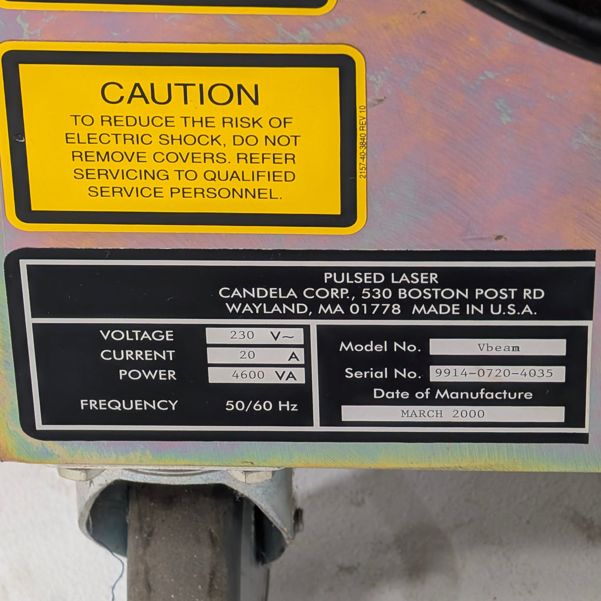 2000 Candela VBeam AS IS SEE NOTES