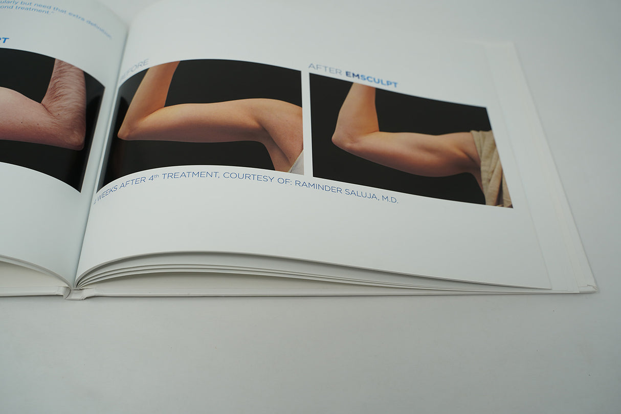 BTL Before & After Marketing Book