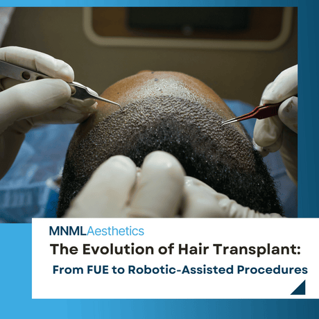 The Evolution of Hair Transplant Technologies: From FUE to Robotic-Assisted Procedures
