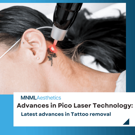 Navigating the Latest Advances in Pico Laser Technology for Tattoo Removal