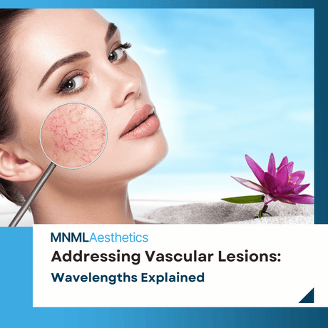 Addressing Vascular Lesions with Precision: Wavelengths Explained