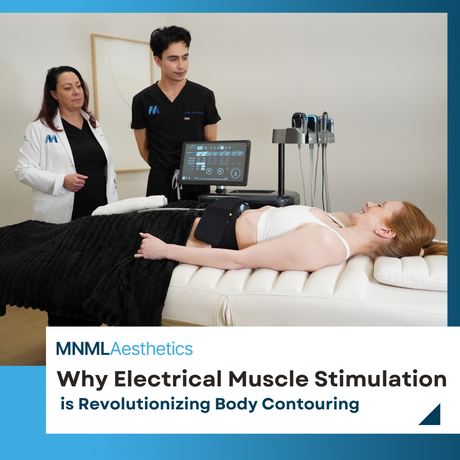 Why Electrical Muscle Stimulation is Revolutionizing Body Contouring