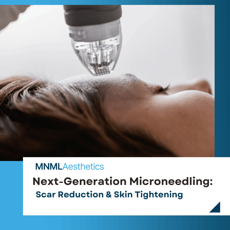 Next-Generation Microneedling RF Devices for Scar Reduction and Skin T ...