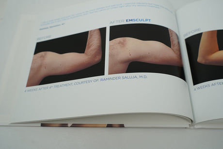 BTL Before & After Marketing Book
